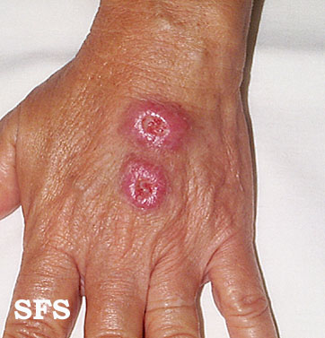 Sensitive research image